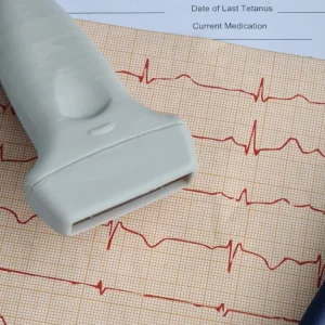 ECG: ADVANCE